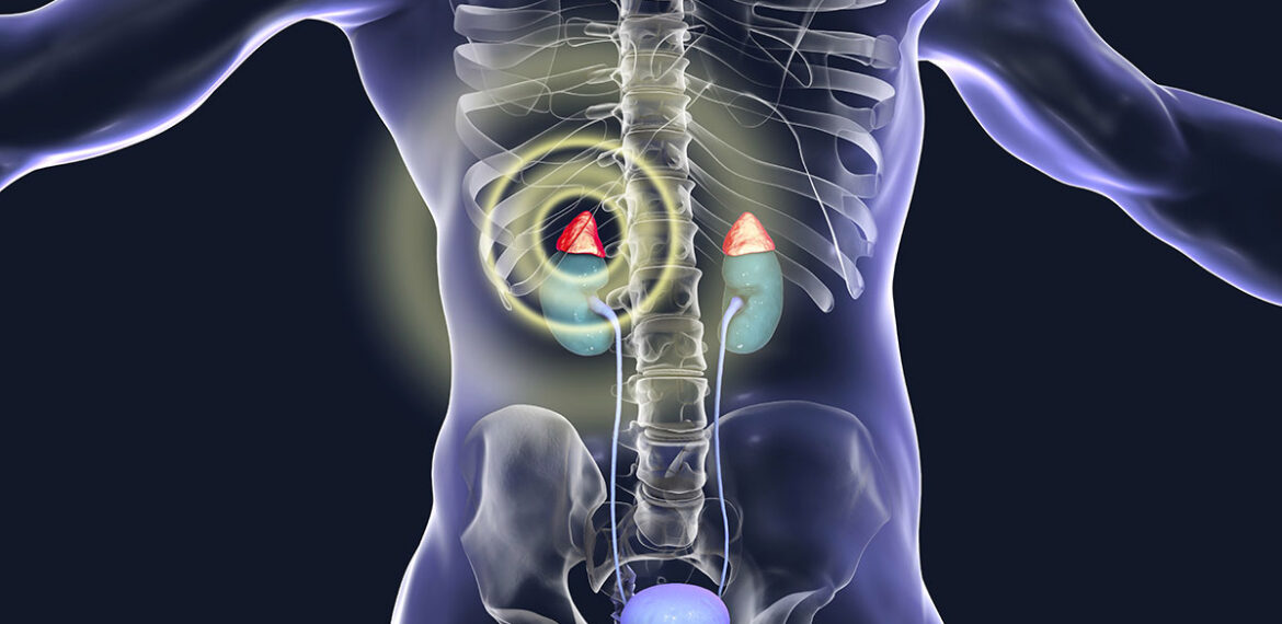 Adrenal Glands Second Opinion