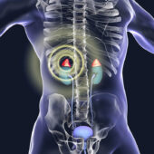 Adrenal Glands Second Opinion