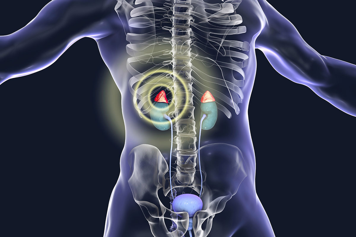 Adrenal Glands Second Opinion