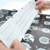 Cardiac Electrophysiology Second Opinion