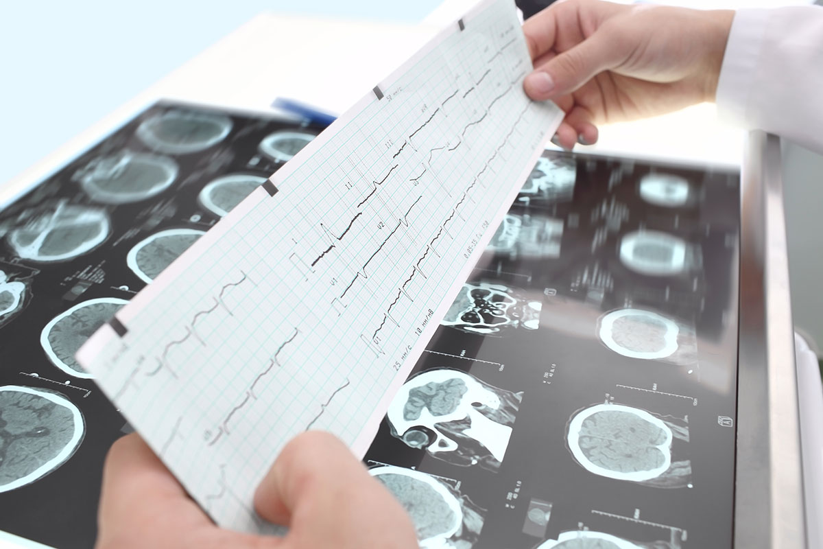 Cardiac Electrophysiology Second Opinion