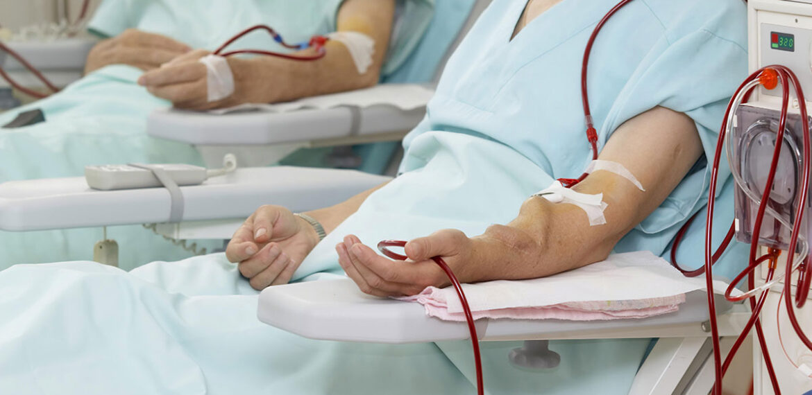 Dialysis Second Opinion