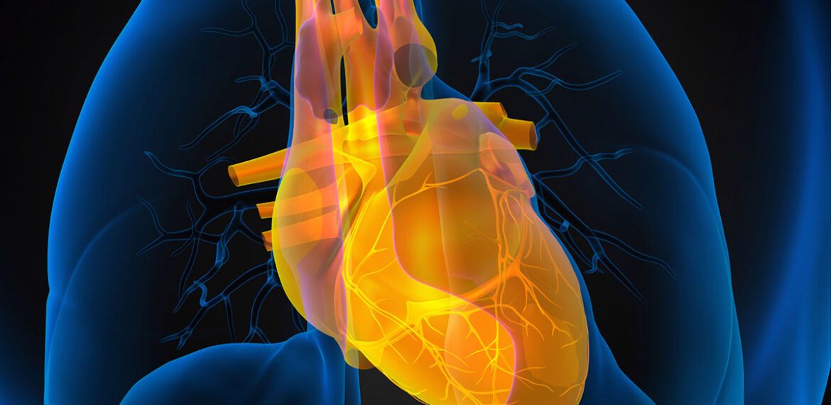Cardiac Mitral Insufficiency Second Opinion