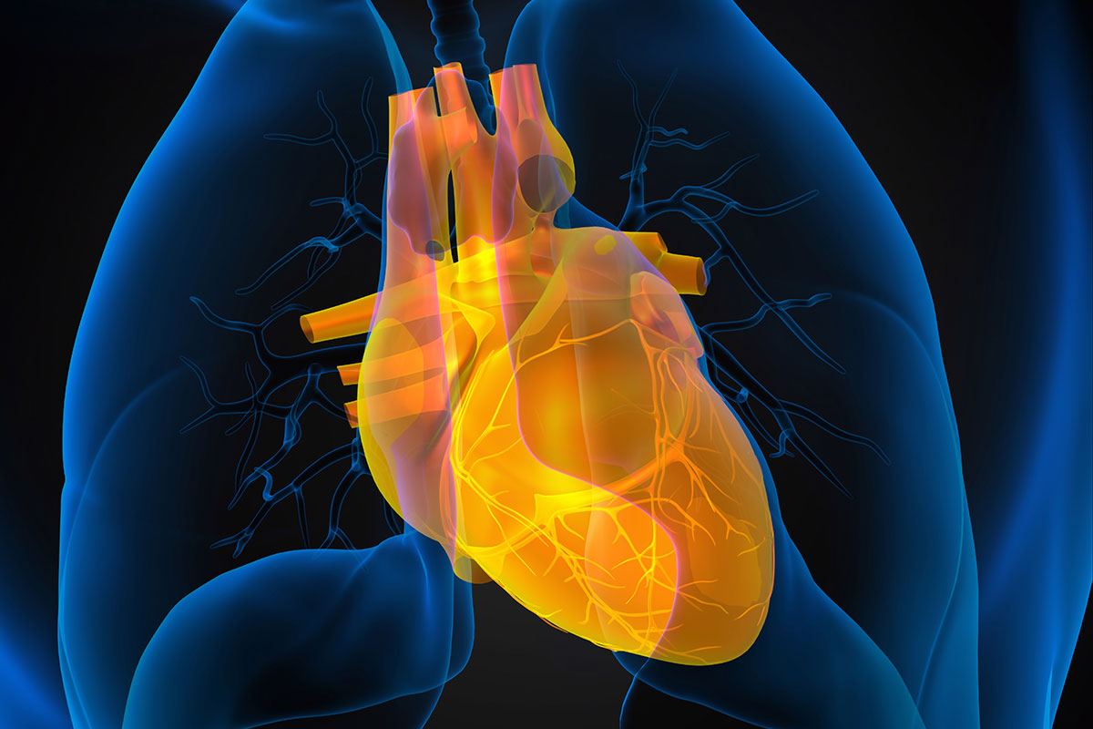 Cardiac Mitral Insufficiency Second Opinion