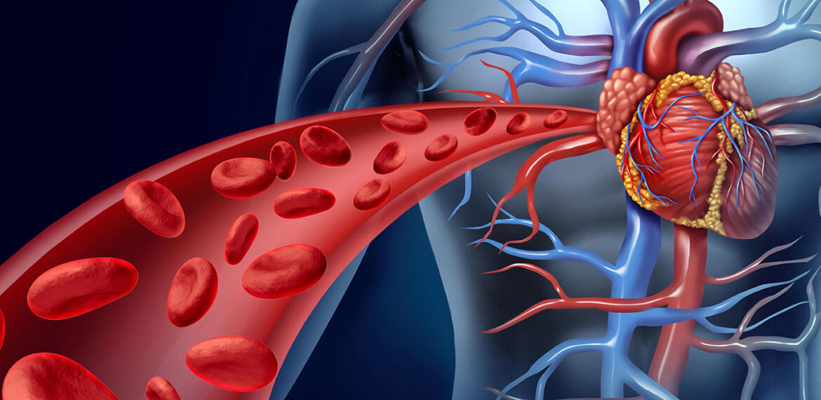 Coronary Artery Disease Second Opinion