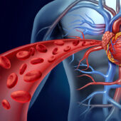 Coronary Artery Disease Second Opinion