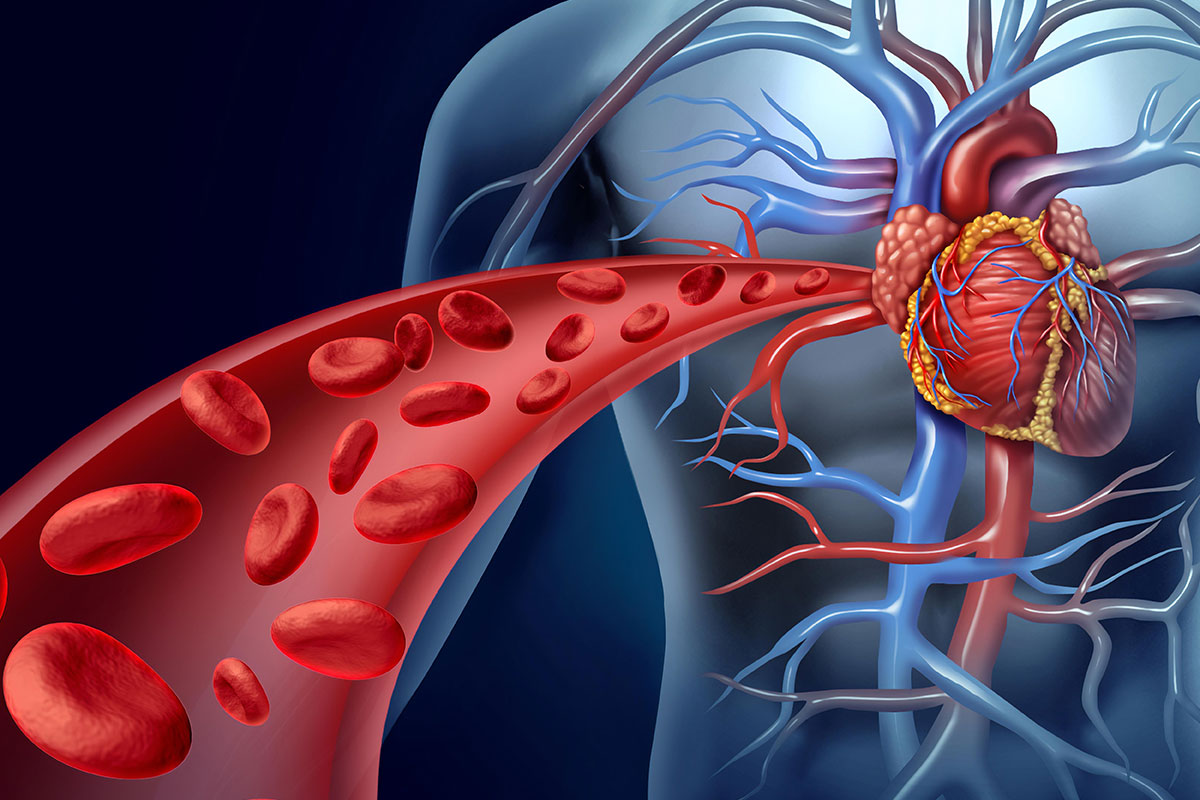 Coronary Artery Disease Second Opinion