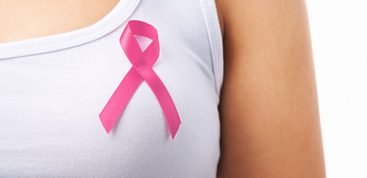 Breast Cancer Second Opinion