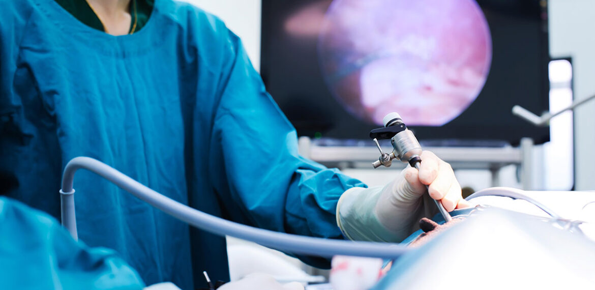 Advanced Laparoscopic Surgery Second Opinion