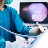 Advanced Laparoscopic Surgery Second Opinion