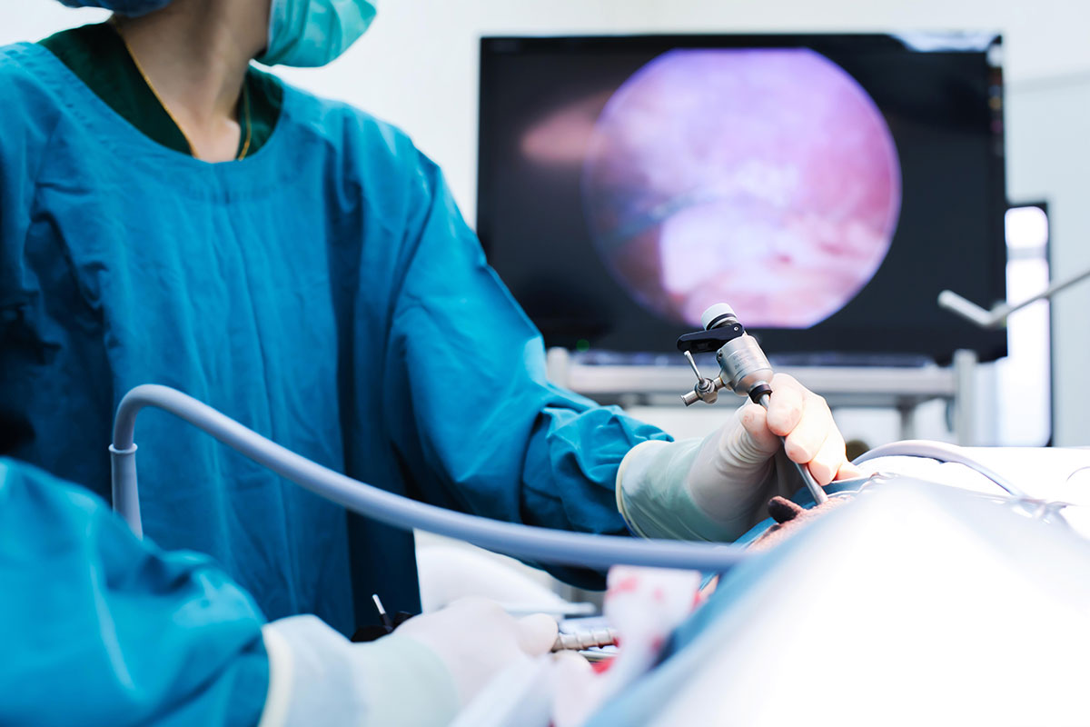 Advanced Laparoscopic Surgery Second Opinion