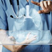 Lung Cancer