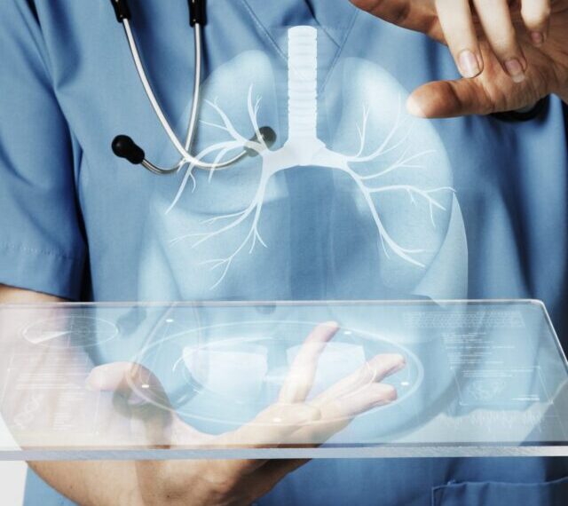 Lung Cancer