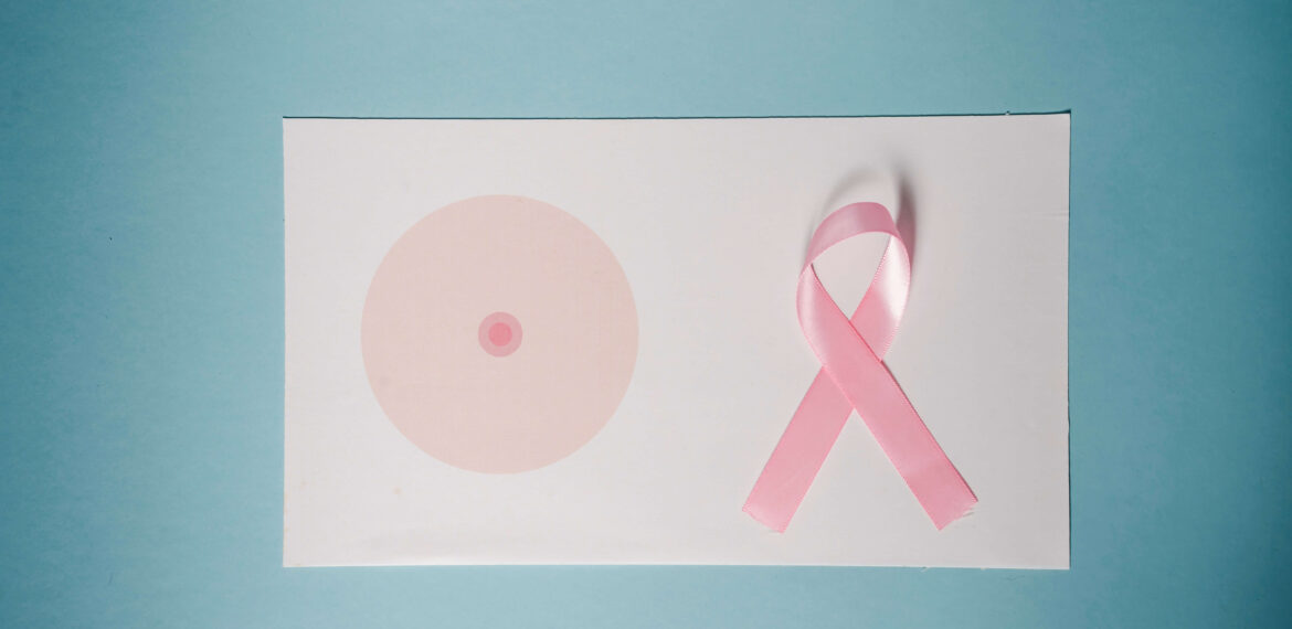 Breast cancer symptoms