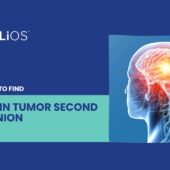 Brain Tumor Second Opinion