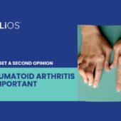 second opinion rheumatoid arthritis