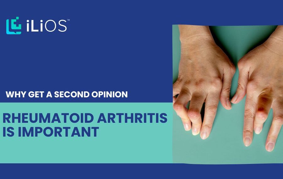 second opinion rheumatoid arthritis