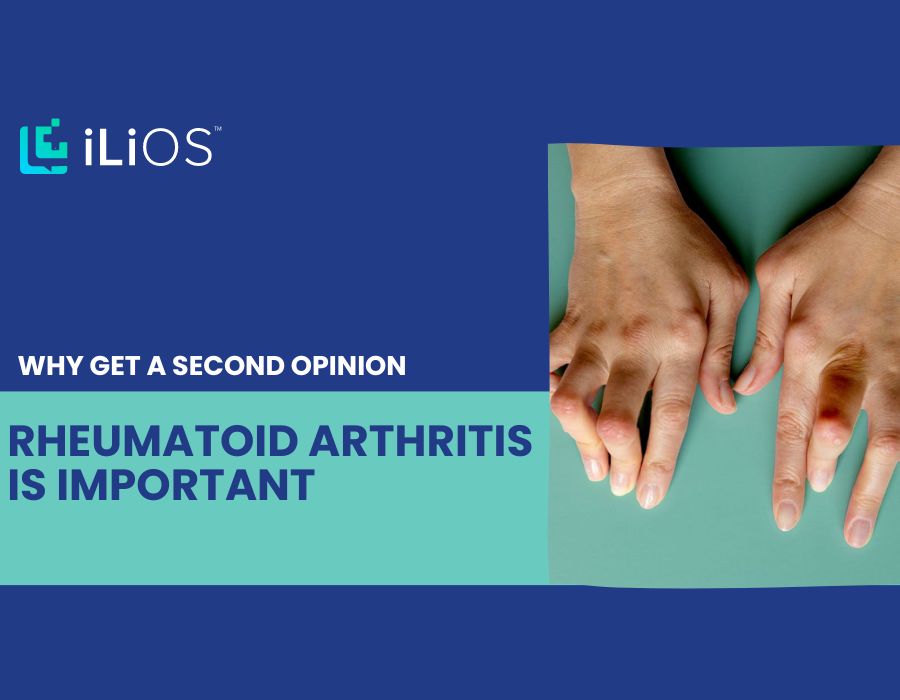 second opinion rheumatoid arthritis