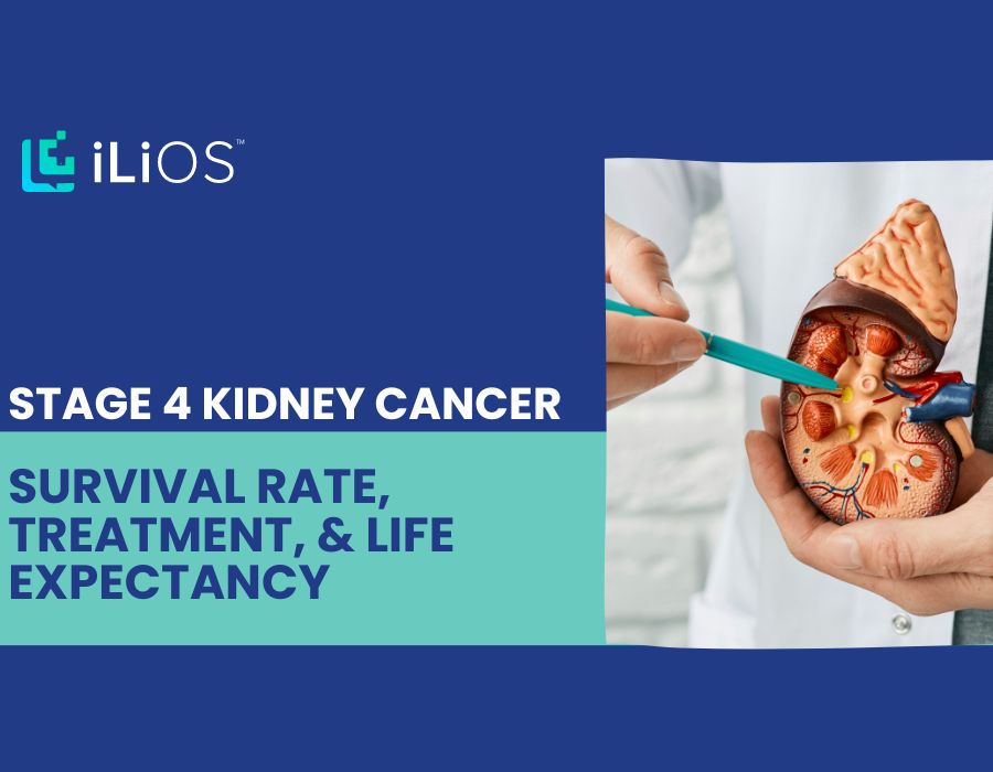 stage 4 kidney cancer
