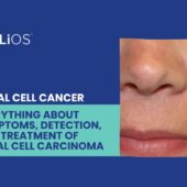 Basal Cell Cancer