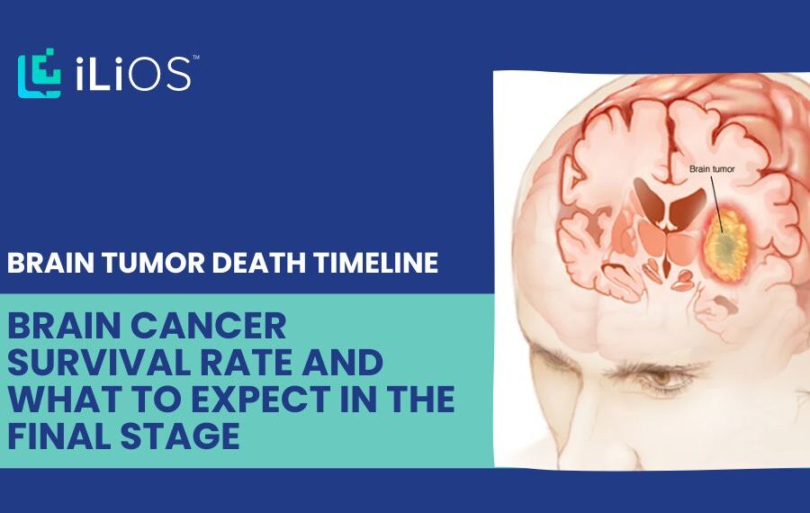 Brain Tumor Death Timeline