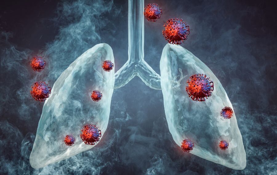 lungs cancer early symptoms