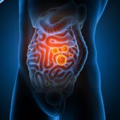 how to increase good bacteria in gut naturally