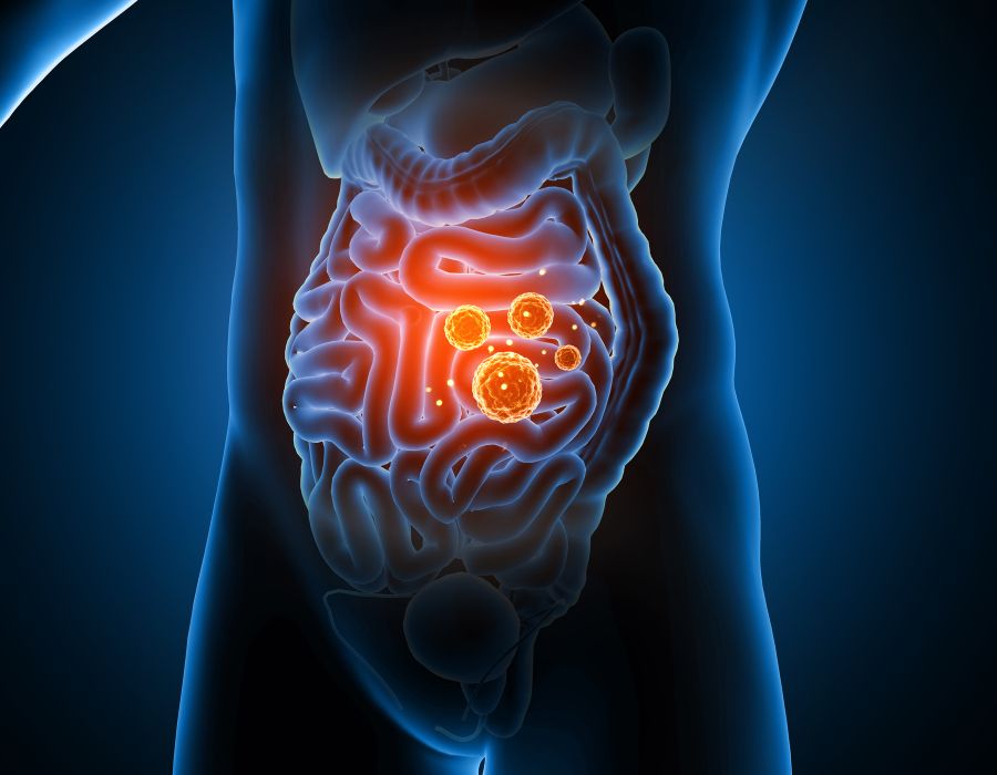 how to increase good bacteria in gut naturally