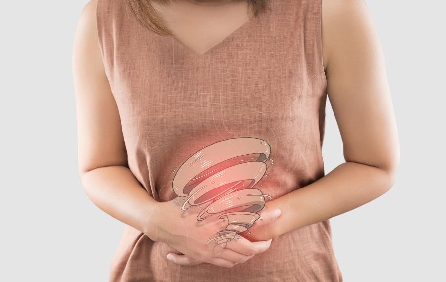 Irritable Bowel Syndrome Treatment