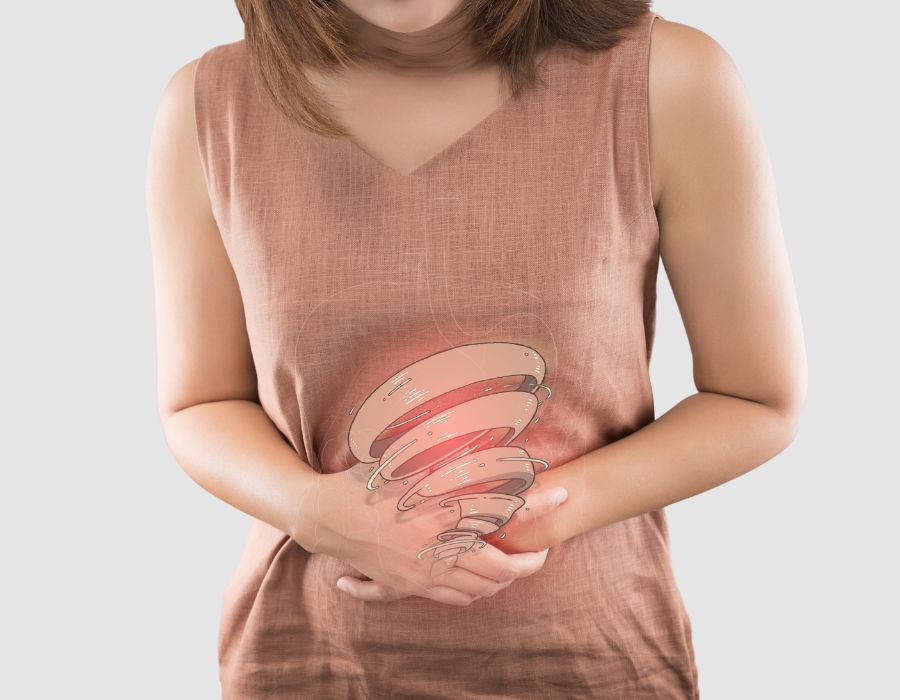 Irritable Bowel Syndrome Treatment