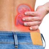 Kidney Stones Causes