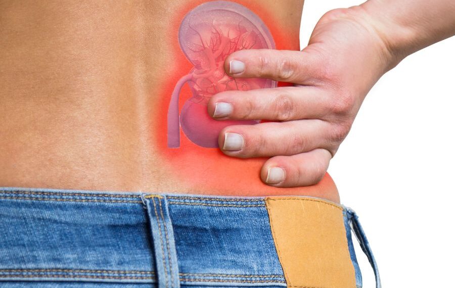 Kidney Stones Causes