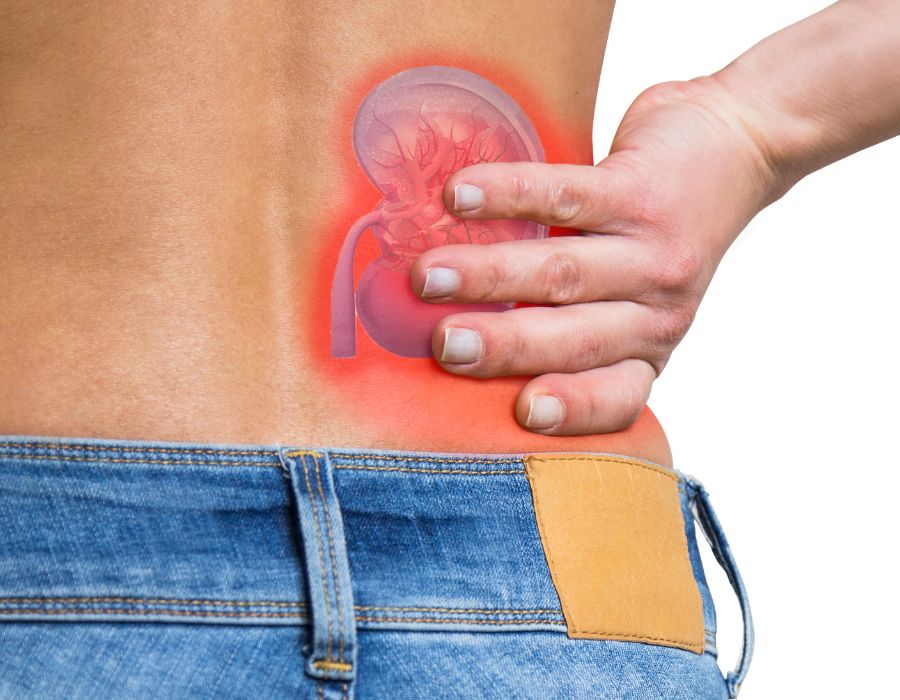 Kidney Stones Causes