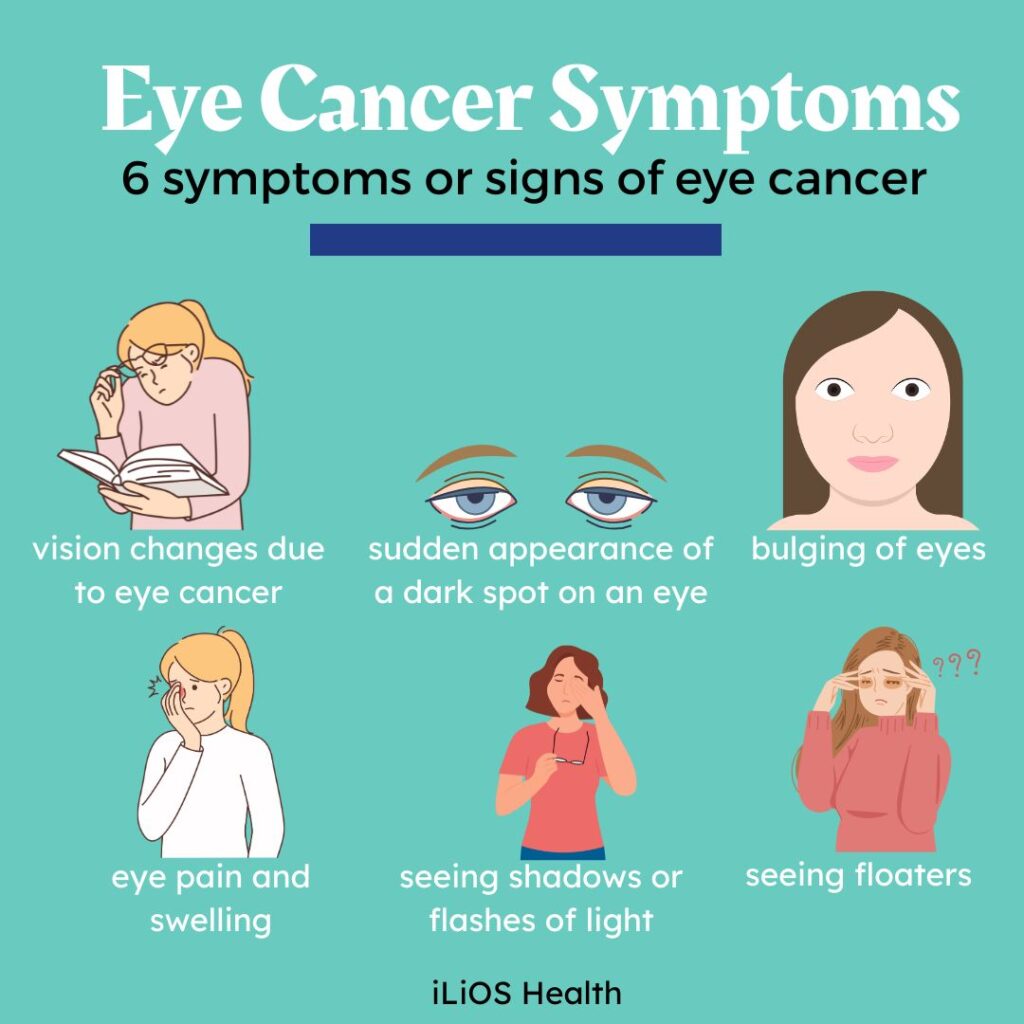 Eye Cancer Symptoms