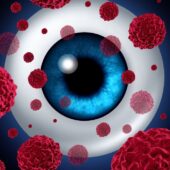 Eye Cancer Symptoms