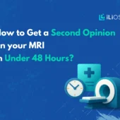 Second-Opinion-on-your-MRI