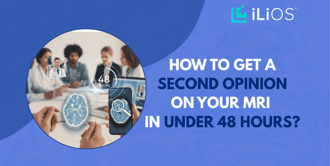 how to get a second opinion on your MRI