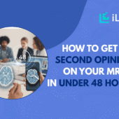 how to get a second opinion on your MRI