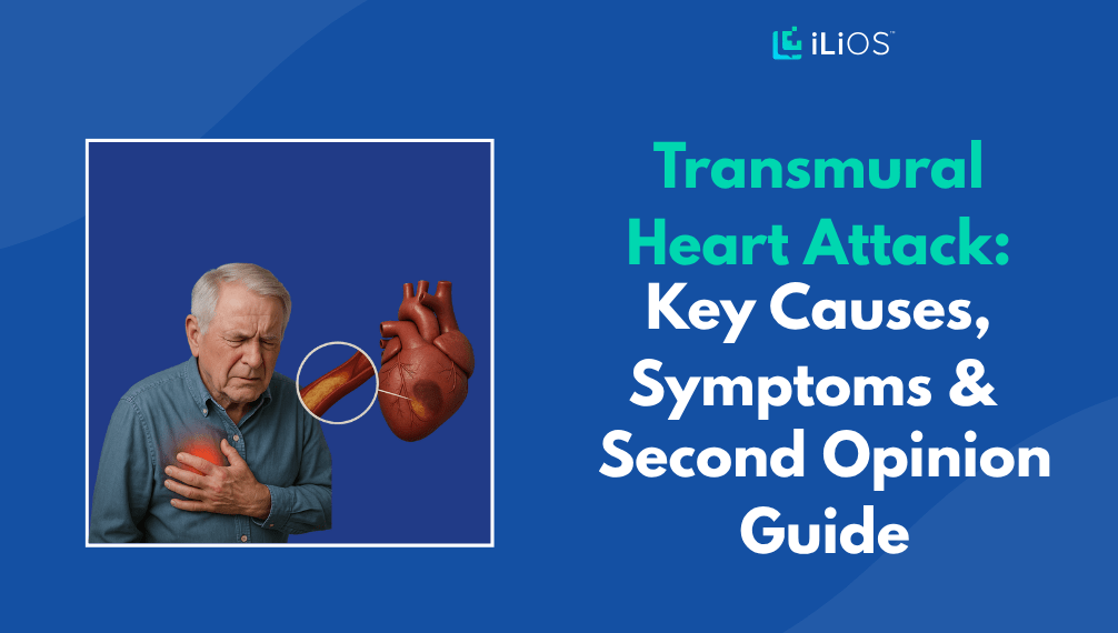 Transmural Heart Attack Causes, Symptoms
