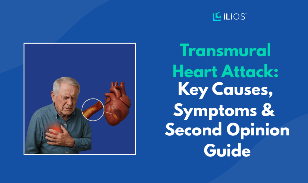 Transmural Heart Attack Causes, Symptoms