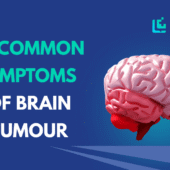 10 sign of Of Brain Tumour