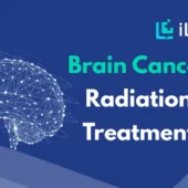 Brain Cancer Radiation Treatment