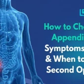 How to Check for Appendicitis Symptoms, Tests & When to Get a Second Opinion