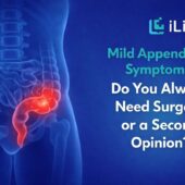 Mild Appendicitis Symptoms banner