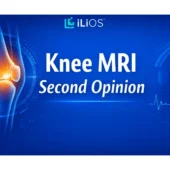 Knee MRI Second Opinion