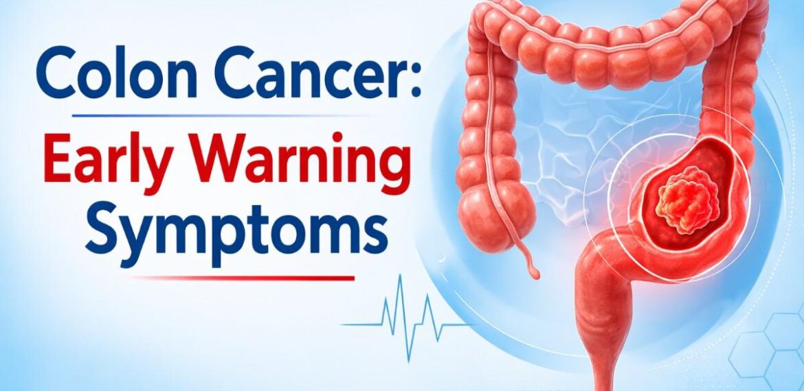 Colon Cancer