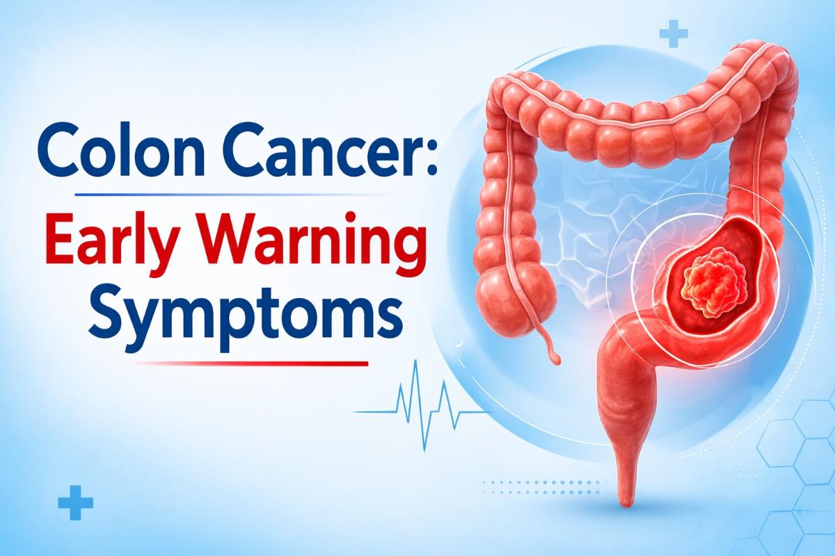 Colon Cancer